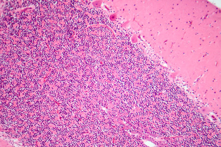 Human cerebellar cortex, photomicrograph showing Purkinje cells, granular cells, and molecular layer involved in motor coordination and balance.の写真素材