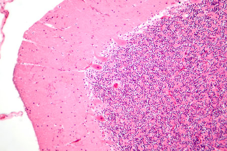 Human cerebellar cortex, photomicrograph showing Purkinje cells, granular cells, and molecular layer involved in motor coordination and balance.の写真素材