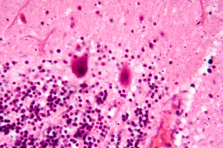 Human cerebellar cortex, photomicrograph showing Purkinje cells, granular cells, and molecular layer involved in motor coordination and balance.の写真素材