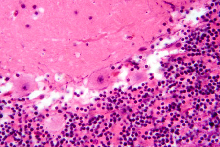 Human cerebellar cortex, photomicrograph showing Purkinje cells, granular cells, and molecular layer involved in motor coordination and balance.の写真素材