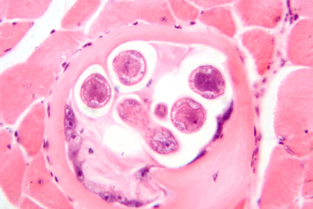 Trichinella spiralis larvae in muscle tissue, photomicrograph showing encysted parasites. Causes trichinosis, a parasitic infection from undercooked meat.の写真素材