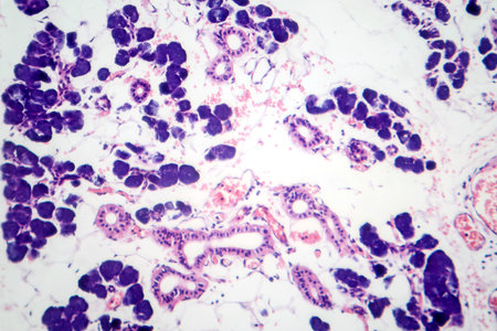 Mixed parotid tumor, photomicrograph showing epithelial and myoepithelial cell components within chondromyxoid stroma, typical of pleomorphic adenoma.の写真素材
