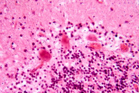 Human motor cortex, photomicrograph showing pyramidal neurons in cortical layers responsible for voluntary movement control and motor coordination.の写真素材