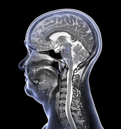 Composite magnetic resonance imaging (MRI) scan and 3D illustration of brain and neck from a 44-year-old patient, showing central nervous system anatomy and cervical spine.の写真素材