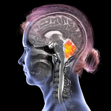 Cerebellum highlighted in the brain of a 44-year-old patient, showing structure involved in balance, coordination, and motor control, colored composite MRI image and 3D illustration.の写真素材