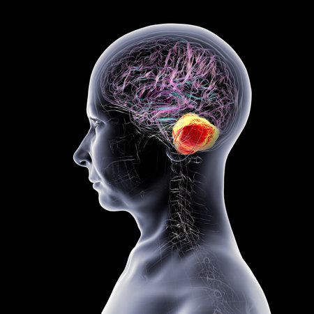 Human brain with highlighted cerebellum, 3D illustration. Cerebellum is responsible for coordination, balance, and fine motor control. Damaged in ataxia and neurodegenerative disorders.の写真素材