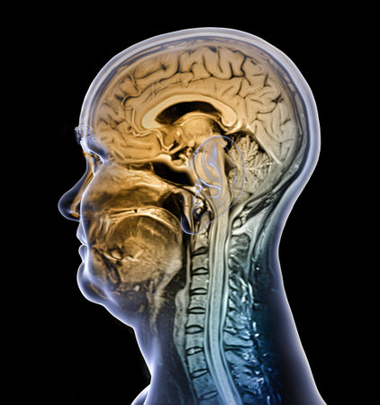 Colored composite magnetic resonance imaging (MRI) scan and 3D illustration of brain and neck from a 44-year-old patient, showing central nervous system anatomy and cervical spine.の写真素材