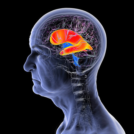 Enlarged lateral ventricles of the brain (hydrocephalus) in a senior person, 3D illustration.