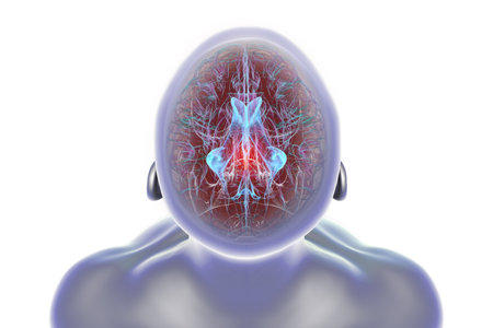 Brain with the cerebral aqueduct highlighted in red and the ventricular system in blue, showcasing...