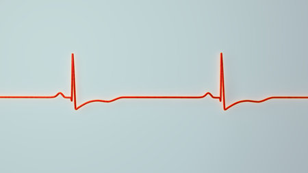 Right ventricular hypertrophy, 3D illustration showing ECG leads V1-V2 with tall R waves and right ventricular activation pattern.の写真素材