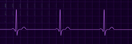 Sinus bradycardia, 3D illustration showing sinus rhythm with prolonged RR intervals and decreased heart rate.の写真素材