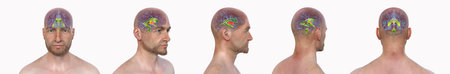 Third brain ventricle, 3D illustration showing the human brain with the third ventricle highlighted...