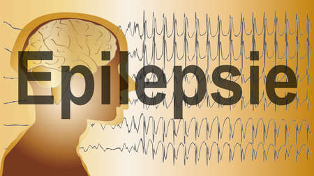 a medical background with a man and epilepsy wavesの写真素材