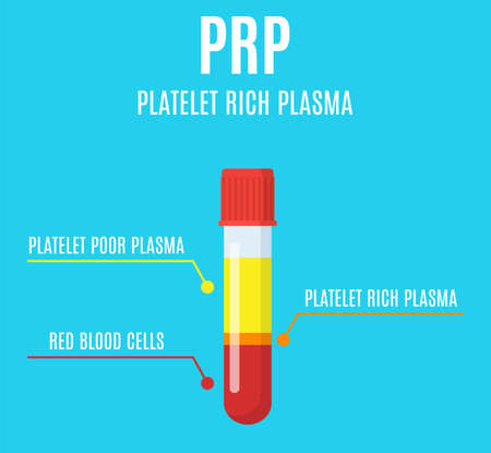 Test tube filled with bloodのイラスト素材