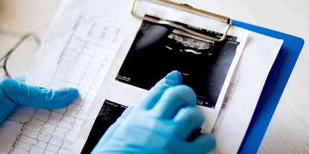 The hands of a male doctor looking at the results of ultrasound.