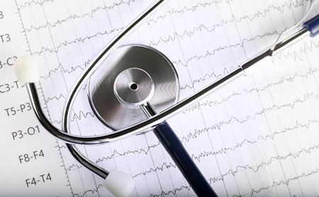 Blue Stethoscope on the electrocardiogram ECG chart paper. ECG heart chart scan isolate on white. Healthcare insurance and medical backgroundの写真素材