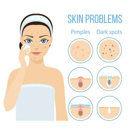 Girl cleans her face with cosmetic lotion. Skin problems solution, home remedies.のイラスト素材