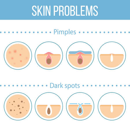 Skin problems icons set.のイラスト素材