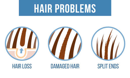 Hair care.  Common hair problems - split ends, damaged hair, hair loss. Vectorのイラスト素材
