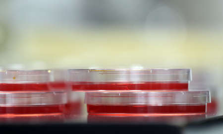 Petri dishes filed with red liquid in Laboratory