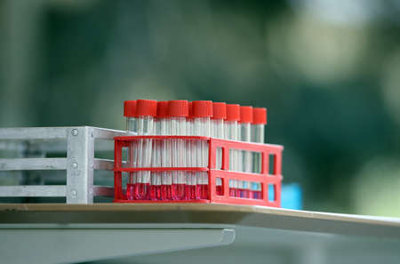 Coronavirus nasal swabs test tubes at drive-through testing point in an effort to curb the spread of...