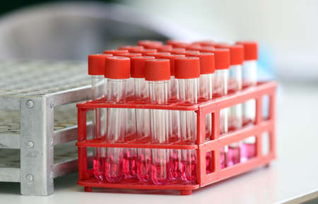 Coronavirus nasal swabs test tubes at drive-through testing point in an effort to curb the spread of COVID-19 (novel coronavirus)の写真素材