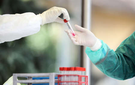 Medical staff member in rubber glowes hands out Coronavirus nasal swabs test tubes at drive-through testing point in an effort to curb the spread of COVID-19 (novel coronavirus)の写真素材