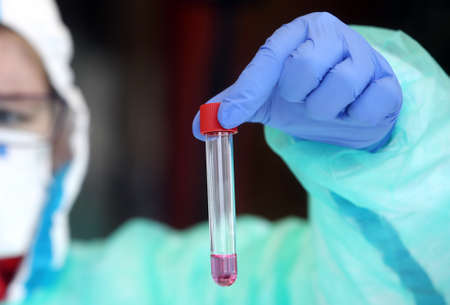 Medical staff member with mask and protective suit holds Coronavirus nasal swabs test tube and coton...
