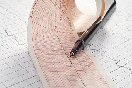 cardiogram and technical pen