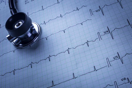 stethoscope and electrocardiogram (ECG)