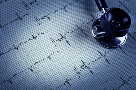 stethoscope and electrocardiogram (ECG)の写真素材