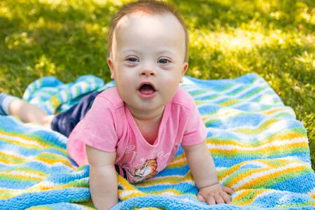 Portrait of Cute baby boy with Down syndrome lying on blanket in summer day on natureの写真素材