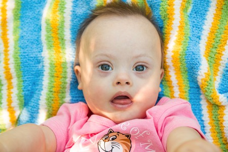 Portrait of Cute baby boy with Down syndrome lying on blanket in summer day on natureの写真素材