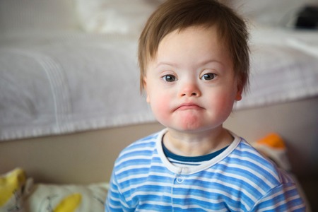 Portrait of cute baby boy with Down syndromeの写真素材