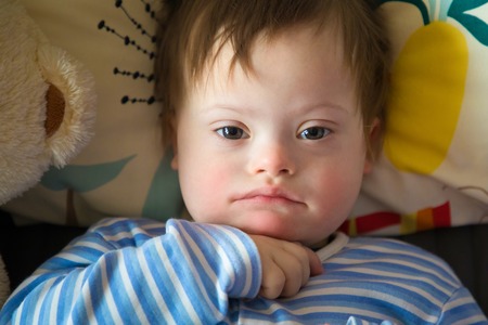 Portrait of cute baby boy with Down syndromeの写真素材