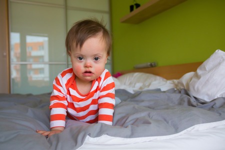 Portrait of cute baby boy with Down syndromeの写真素材