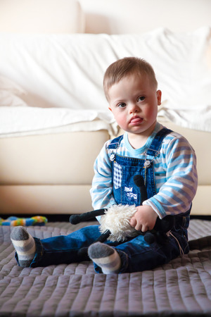 Portrait of cute baby boy with Down syndromeの写真素材