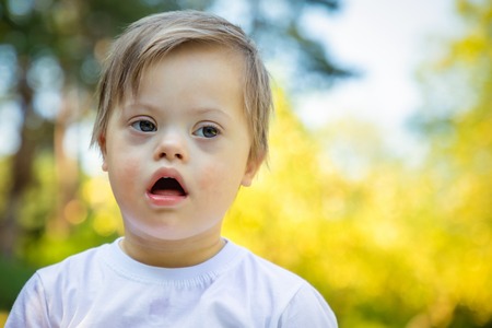 Portrait of Cute small boy with Down syndrome playing in summer day on natureの写真素材