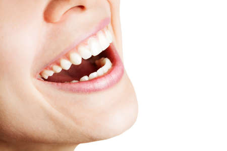 Laugh of happy woman with healthy white teethの写真素材