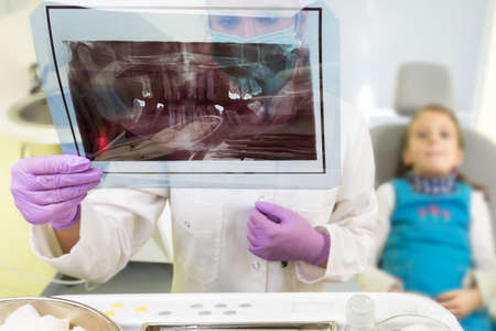 Dentist looking at teeth x-rayの写真素材