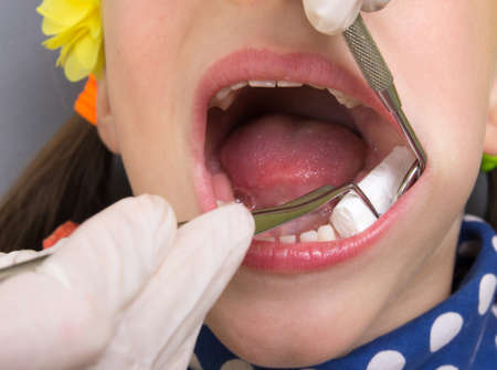 Little girl having her teeth examinedの写真素材