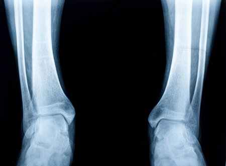 Xray of a human ankle isolatedの写真素材