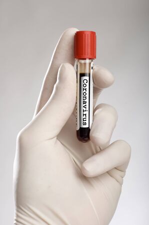 Hand holding infected blood test tube coronavirusの写真素材