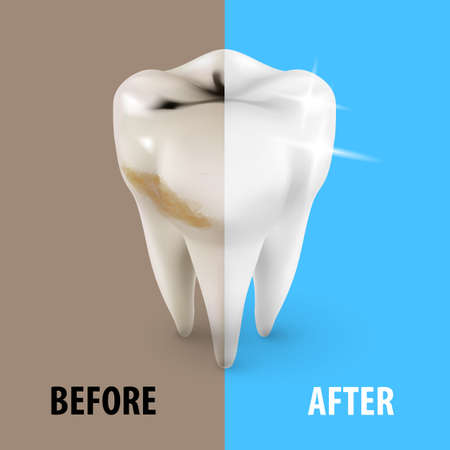 Teeth Whitening Icon, Dentist Symbol in Isometric Styleのイラスト素材