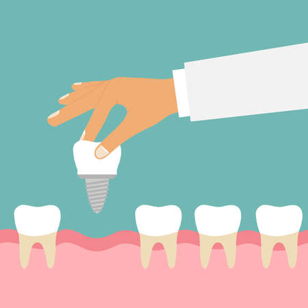 The hand holds the tooth implant.