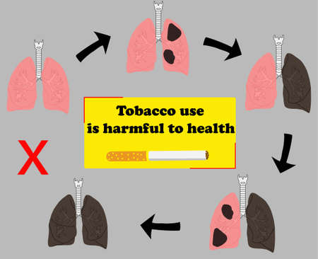 no tobacco, representing the deterioration of the lungs due to tobacco use, with the phrase, tobacco use is harmful to healthのイラスト素材