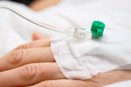 Close up of a iv drip in patient's handの写真素材