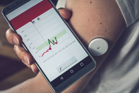 Woman checking glucose level with a remote sensor and mobile phone, sensor checkup glucose levels without blood. Diabetes treatment.の写真素材