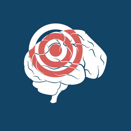 Brain tumor vector designのイラスト素材