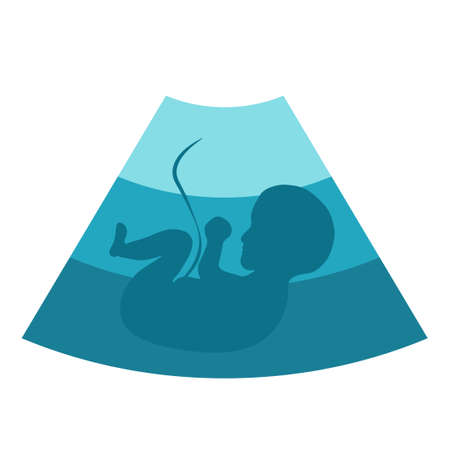 Ultrasound of baby in pregnant womanのイラスト素材